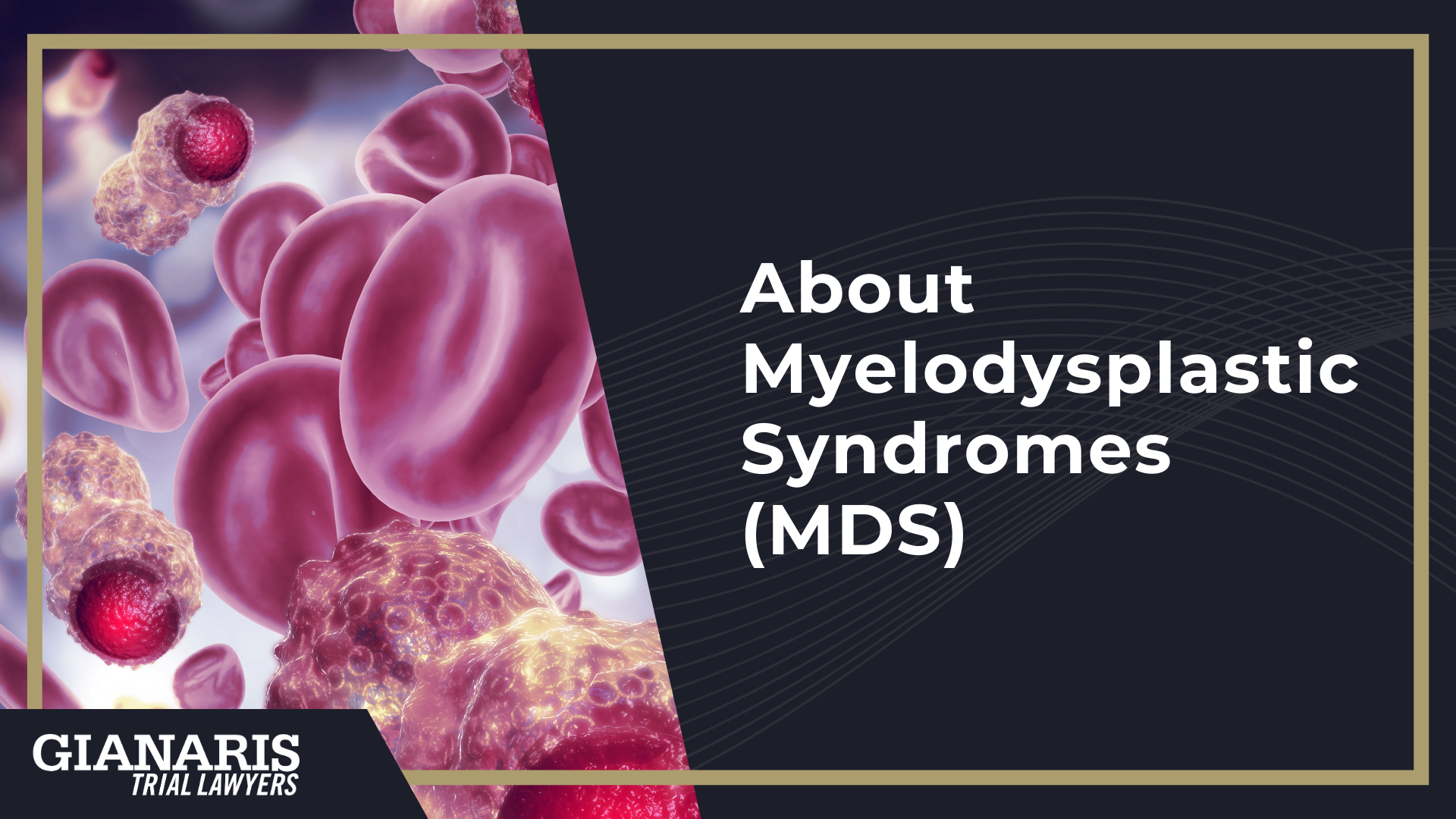 How are Myelodysplastic Syndromes Linked to the Railroad Industry; Railroad Jobs Linked to an Increased Risk of Myelodysplastic Syndromes; About Myelodysplastic Syndromes (MDS)