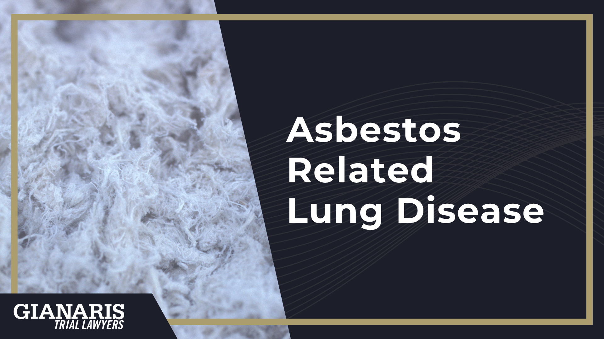 Employer Negligence; Asbestos Related Lung Disease