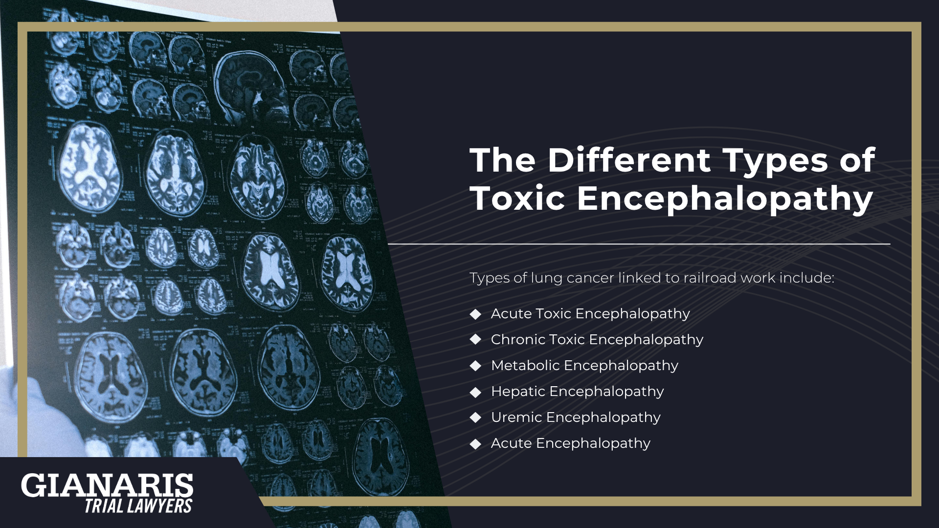 Railroad Jobs Linked to an Increased Risk of Toxic Encephalopathy; About Toxic Encephalopathy; Symptoms and Complications of Toxic Encephalopathy; The Different Types of Toxic Encephalopathy