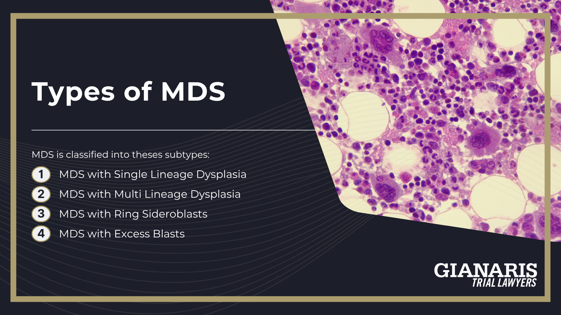Types of MDS