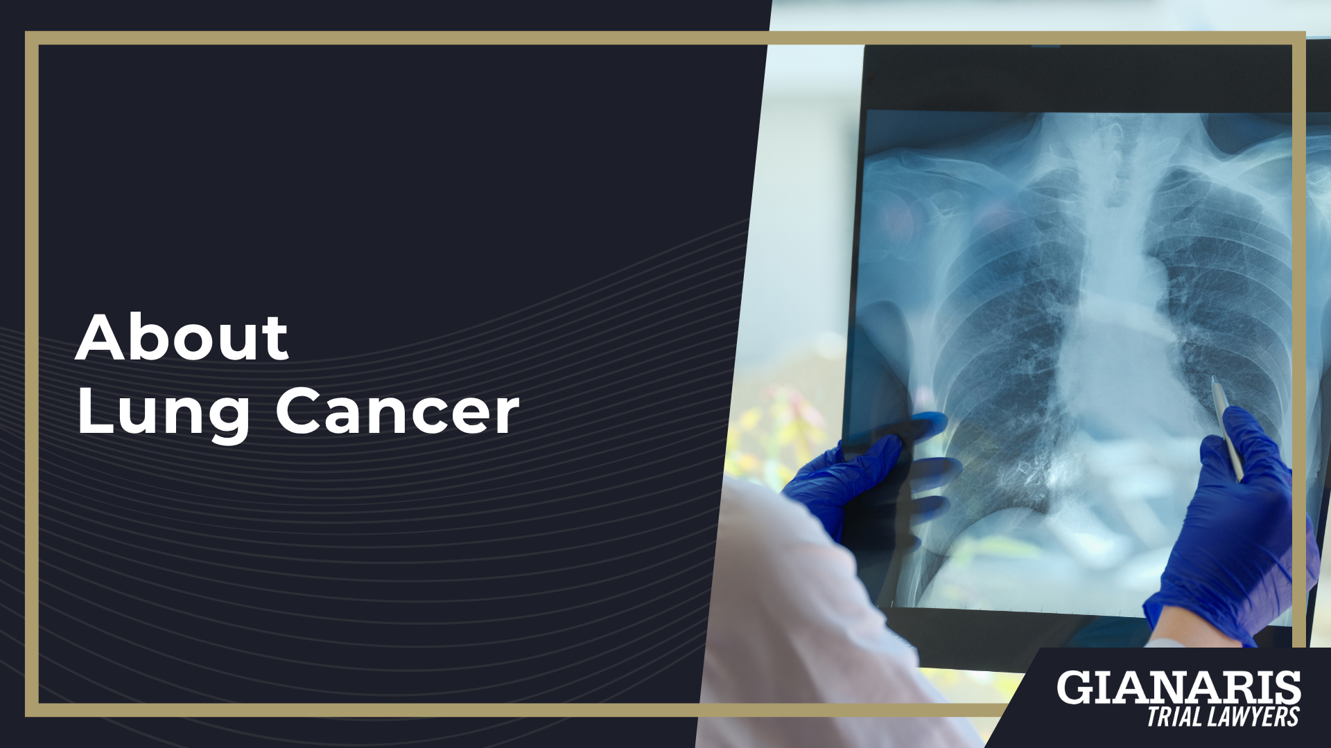 How is Lung Cancer Linked to the Railroad Industry; Railroad Jobs Linked to an Increased Risk of Lung Cancer; About Lung Cancer