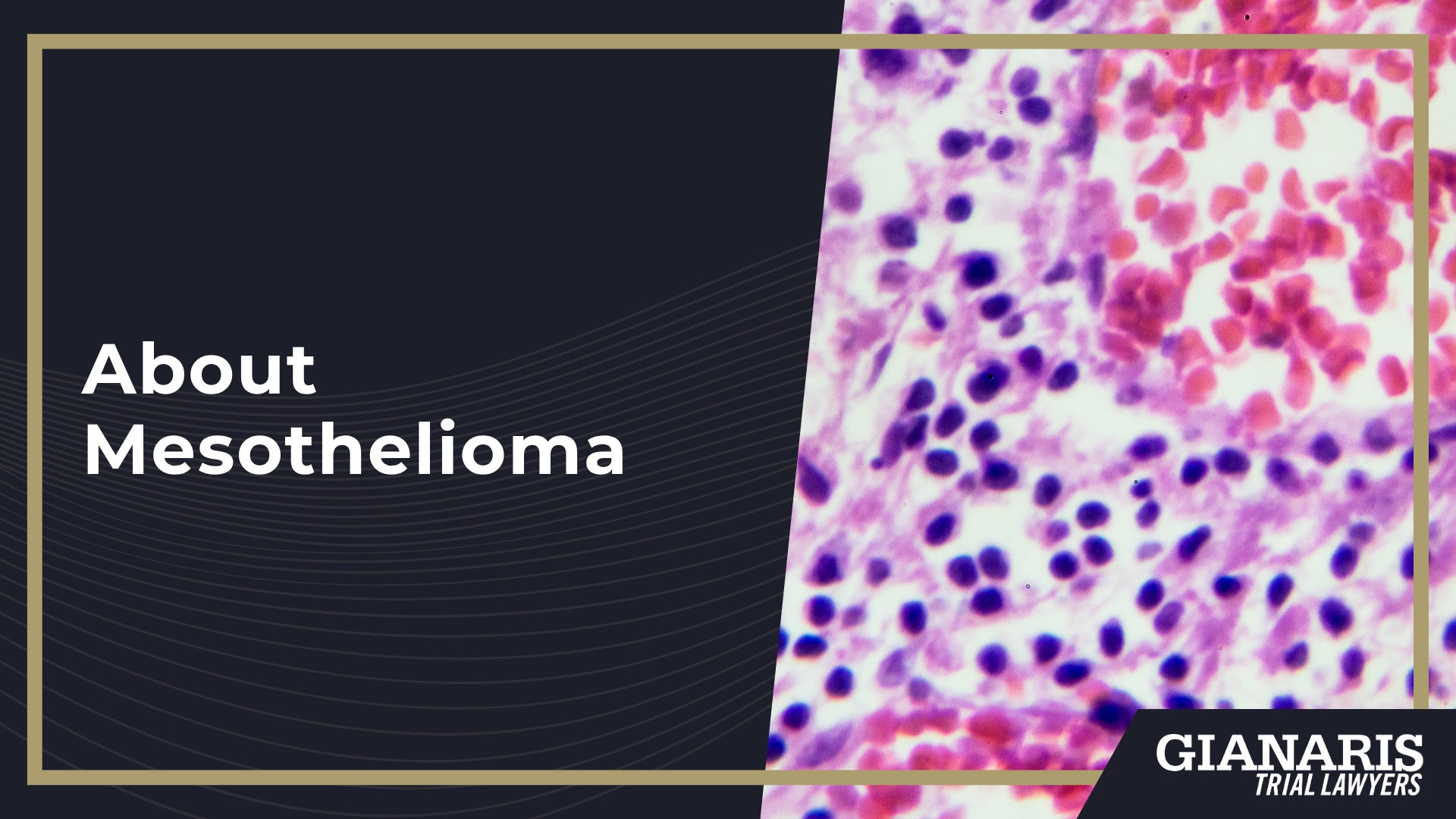 How is Mesothelioma Linked to the Railroad Industry; Railroad Jobs Linked to an Increased Risk of Asbestos Exposure and Mesothelioma; Can I File a Wrongful Death Lawsuit if My Loved One Passed Away of Mesothelioma; About Mesothelioma