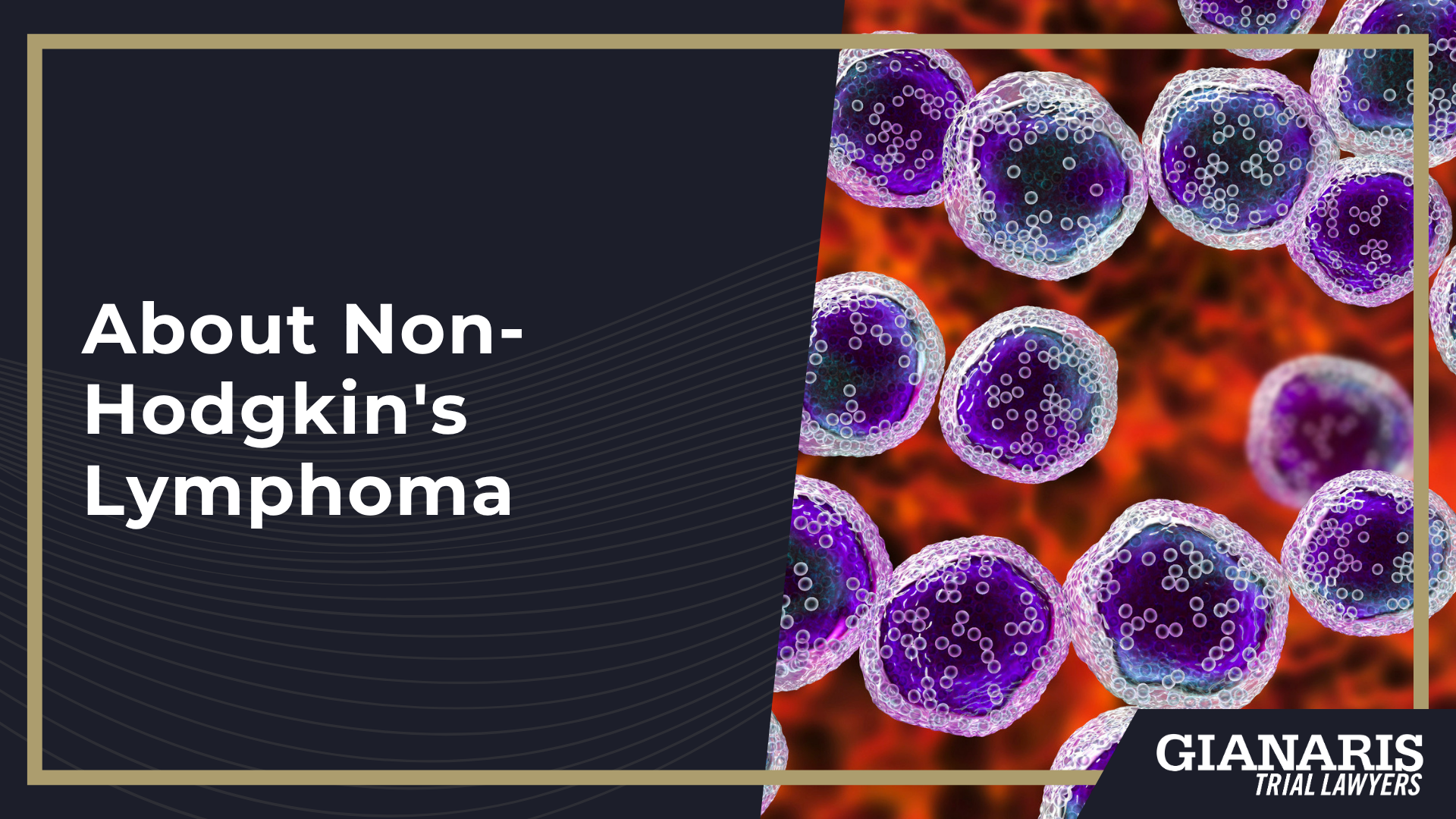 How is Non-Hodgkin's Lymphoma Linked to Railroad Work; Railroad Job Roles Linked to High Levels of Benzene Exposure & NHL Diagnoses; About Non-Hodgkin's Lymphoma