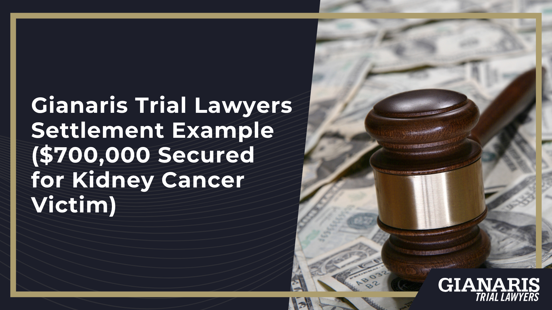 Average Railroad Cancer Settlement Amounts and Verdict Figures; Recoverable Damages in Railroad Cancer Lawsuits; Types of Evidence Used to Prove Negligence in a Railroad Cancer Lawsuit; Gianaris Trial Lawyers Settlement Example ($700,000 Secured for Kidney Cancer Victim)