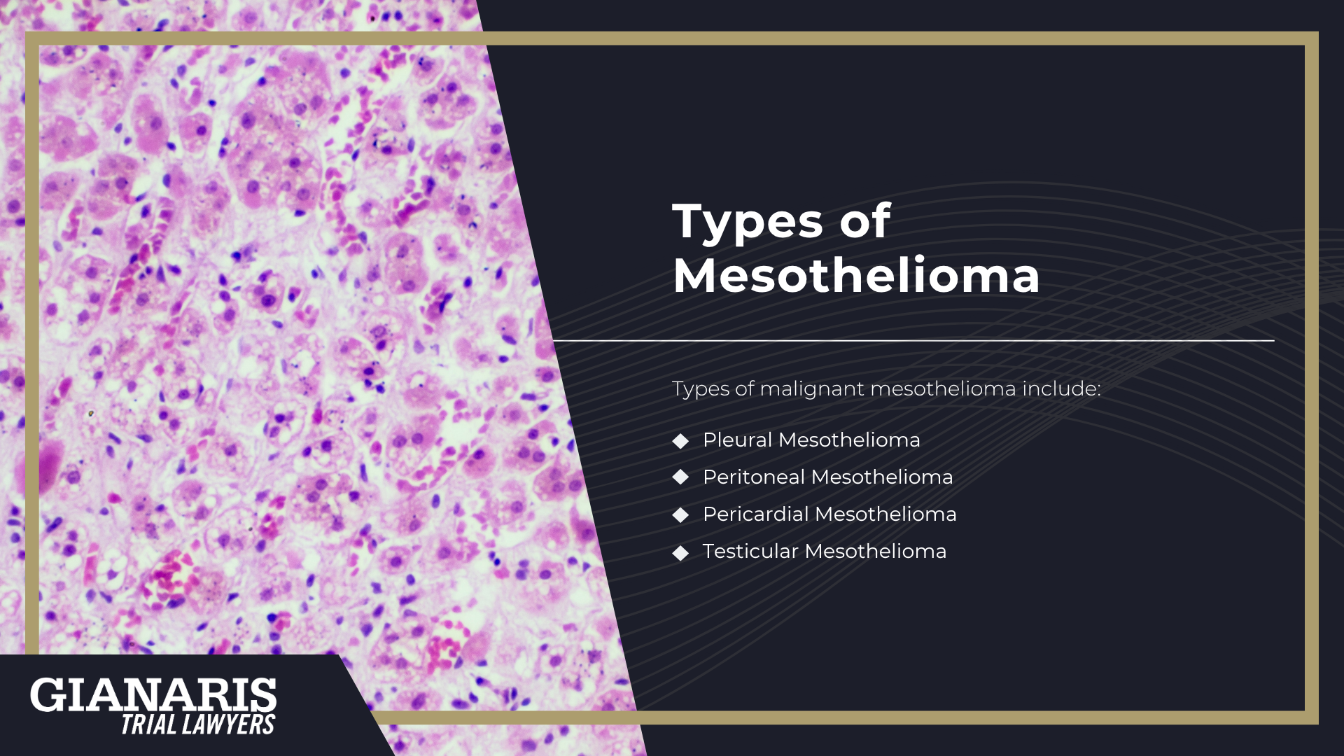 How is Mesothelioma Linked to the Railroad Industry; Railroad Jobs Linked to an Increased Risk of Asbestos Exposure and Mesothelioma; Can I File a Wrongful Death Lawsuit if My Loved One Passed Away of Mesothelioma; About Mesothelioma; How is Mesothelioma Linked to the Railroad Industry; Railroad Jobs Linked to an Increased Risk of Asbestos Exposure and Mesothelioma; Can I File a Wrongful Death Lawsuit if My Loved One Passed Away of Mesothelioma; About Mesothelioma; Types of Mesothelioma