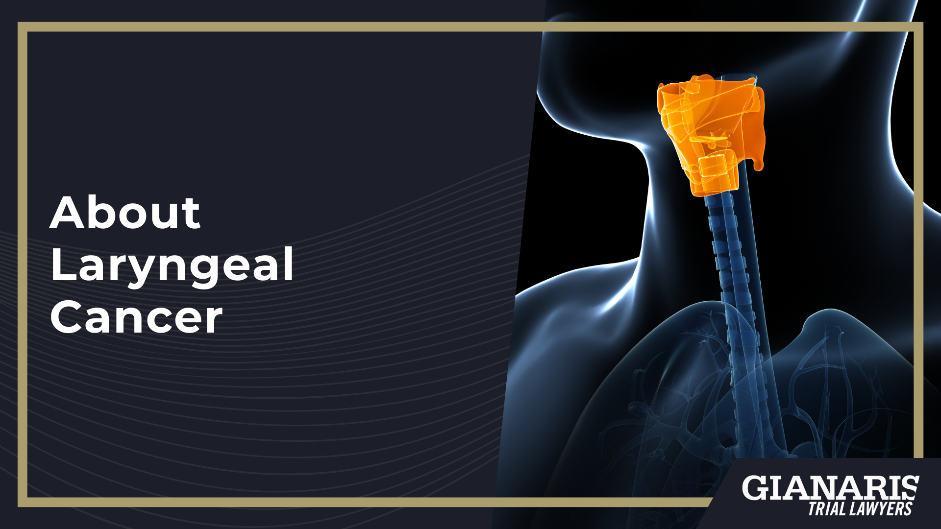 How is Laryngeal Cancer Linked to the Railroad Industry; Toxic Chemicals in Railroad Work Linked to Laryngeal Cancer; What Railroad Jobs are at the Highest Risk of Laryngeal Cancer; About Laryngeal Cancer
