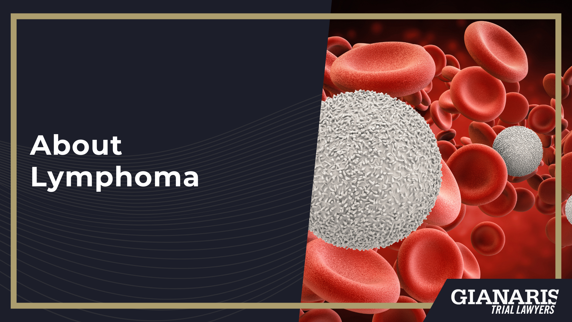 How is Lymphoma Linked to the Railroad Industry; Toxic Exposures on the Railroad Potentially Linked to Lymphoma; About Lymphoma