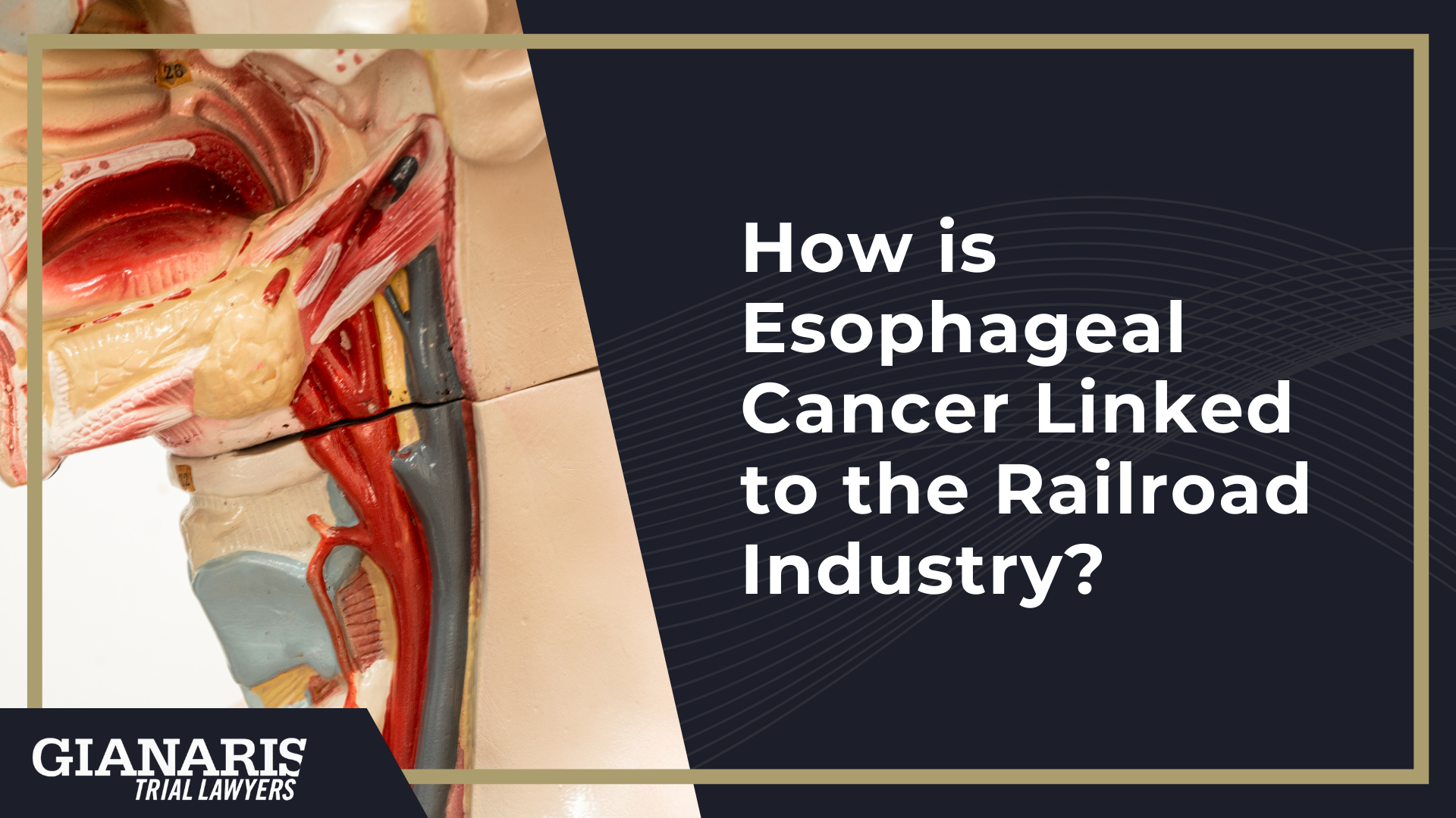 How is Esophageal Cancer Linked to the Railroad Industry