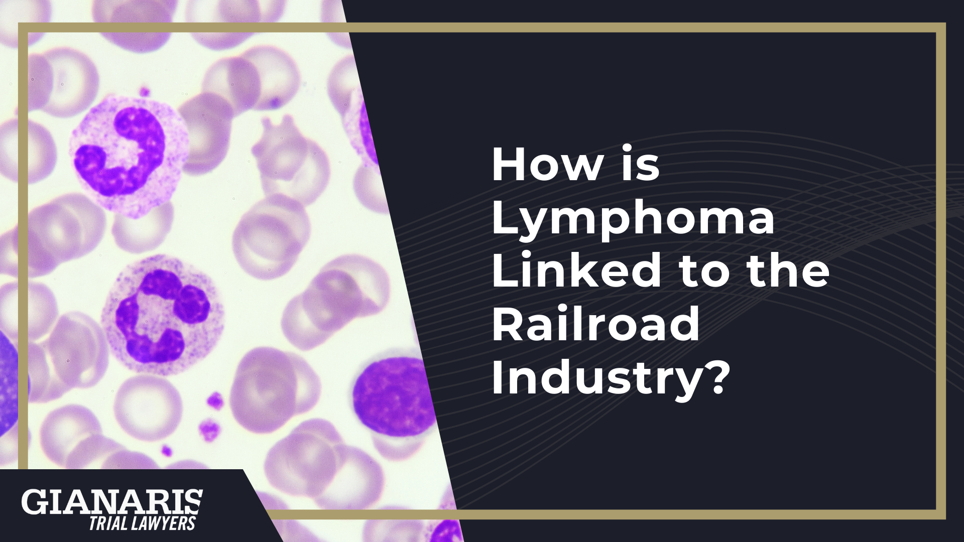 How is Lymphoma Linked to the Railroad Industry
