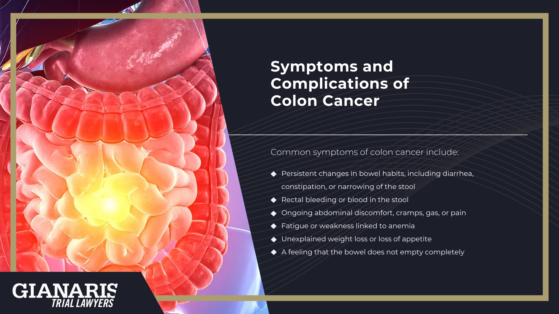 How is Colon Cancer Linked to the Railroad Industry; About Colon Cancer; Symptoms and Complications of Colon Cancer