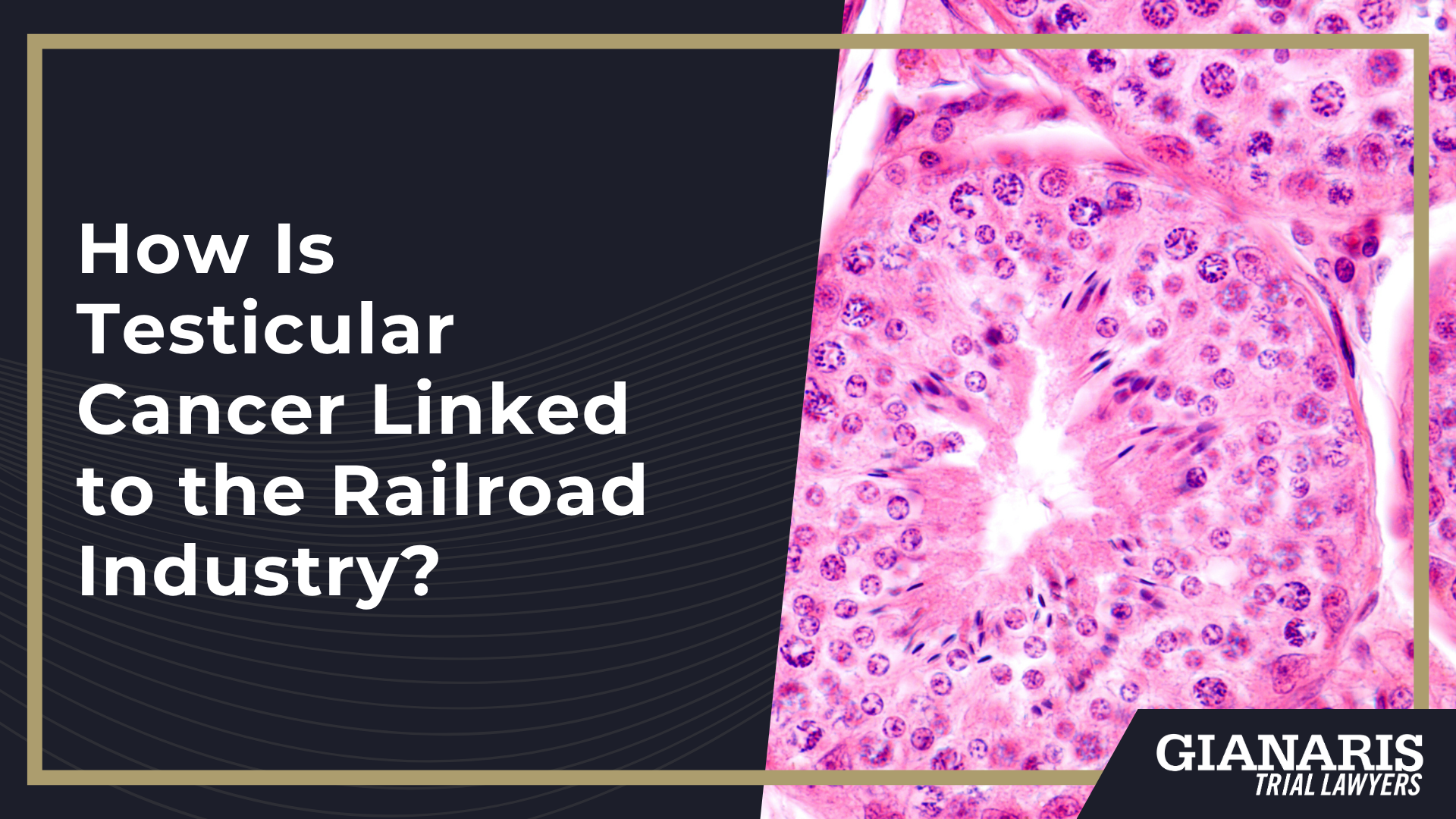 How Is Testicular Cancer Linked to the Railroad Industry