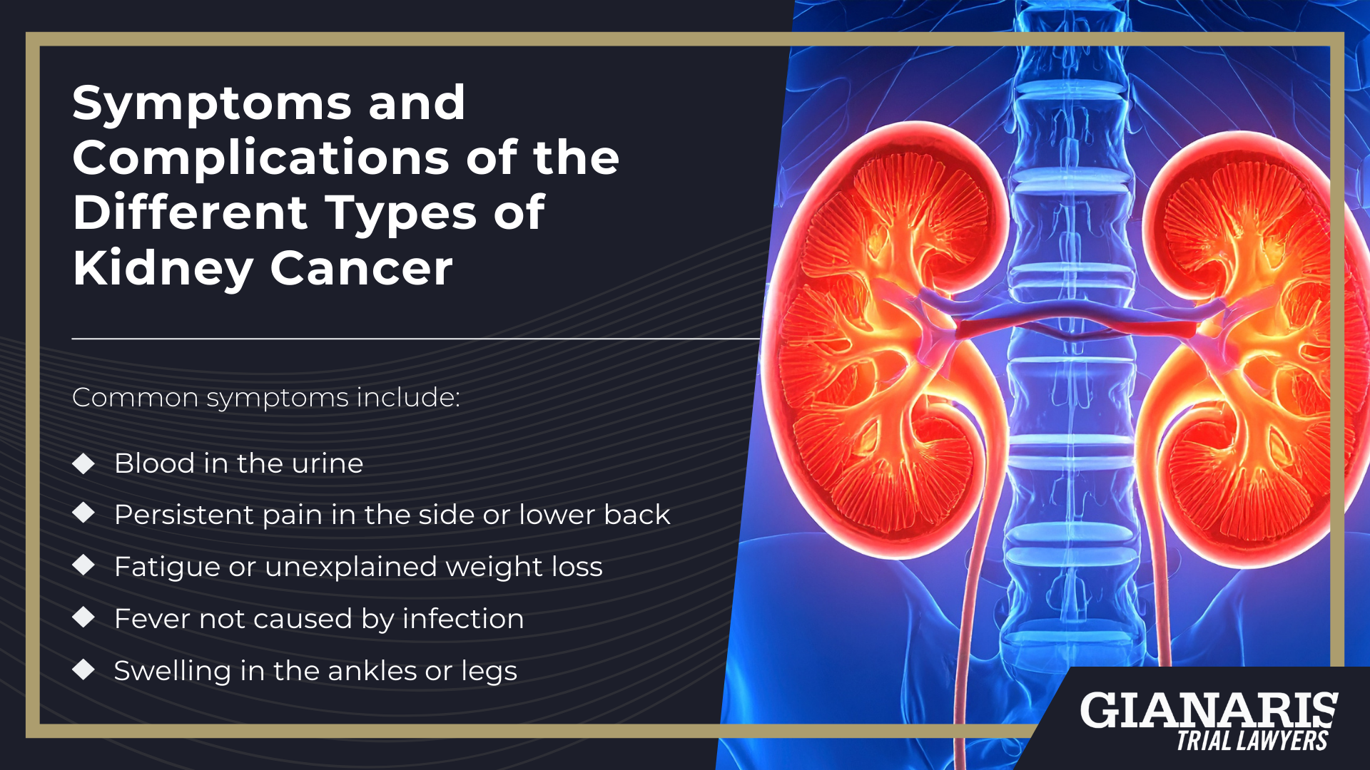 How Is Kidney Cancer Linked to the Railroad Industry; Symptoms and Complications of the Different Types of Kidney Cancer; Kidney Cancer From the Railroad