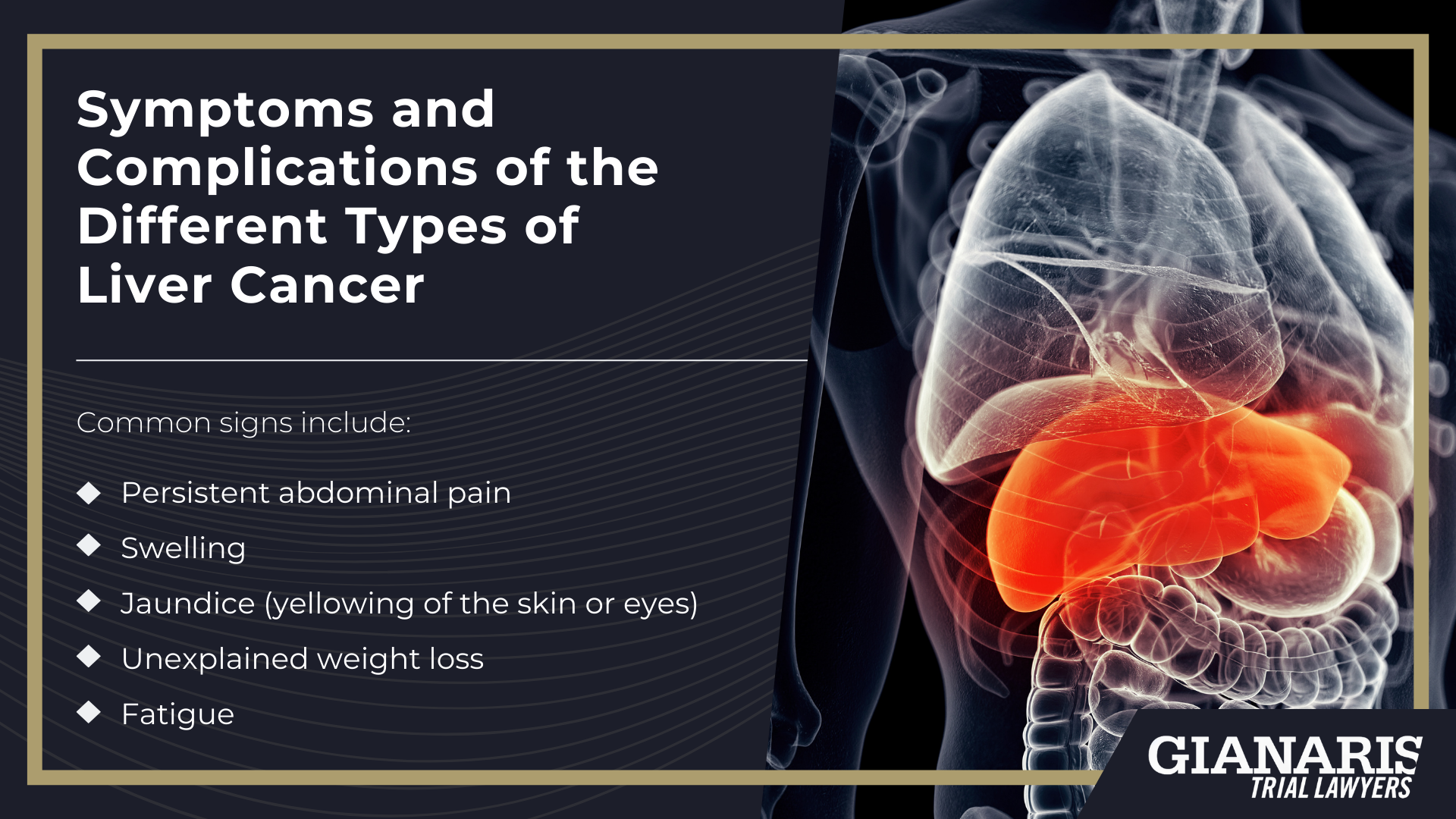 How Is Liver Cancer Linked to the Railroad Industry; What Is Liver Cancer; Symptoms and Complications of the Different Types of Liver Cancer
