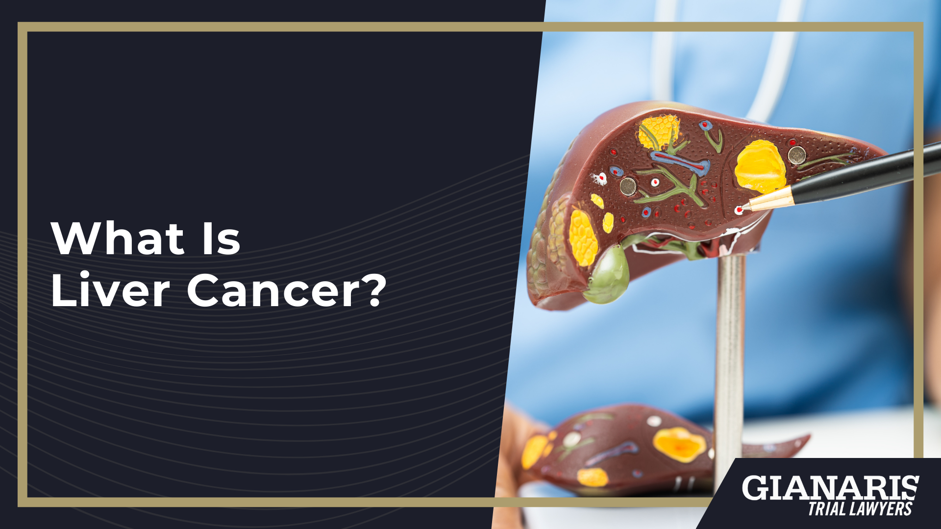 How Is Liver Cancer Linked to the Railroad Industry; What Is Liver Cancer