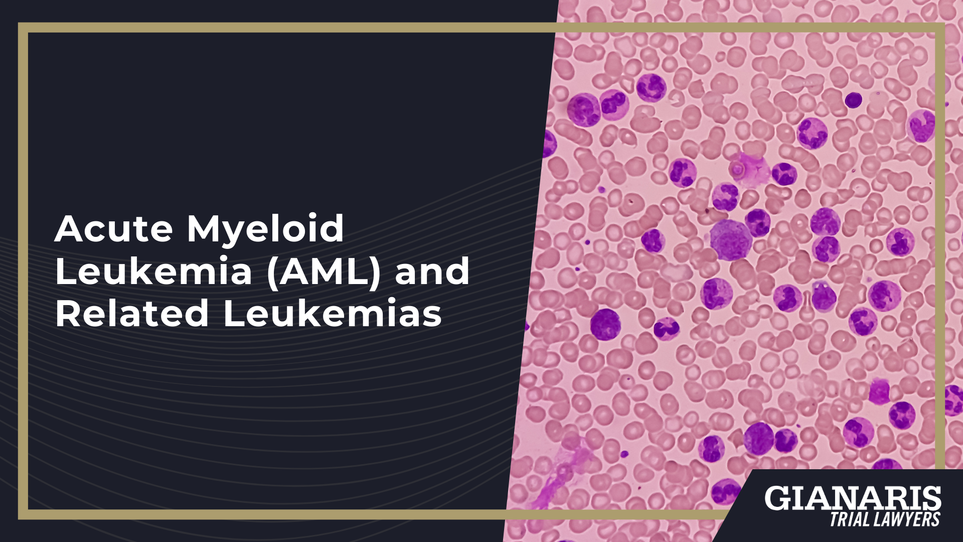 Understanding Eligibility in Benzene Exposure Claims; Why Benzene Lawsuits Focus on Exposure History and Medical Diagnosis; Documented Benzene Exposure_ The First Qualification Requirement; Occupational Benzene Exposure_ High-Risk Industries and Job Roles; Environmental and Community Exposure to Benzene; Medical Conditions Commonly Associated With Benzene Exposure; Other Blood and Bone Marrow Disorders Linked to Benzene Exposure; Acute Myeloid Leukemia (AML) and Related Leukemias