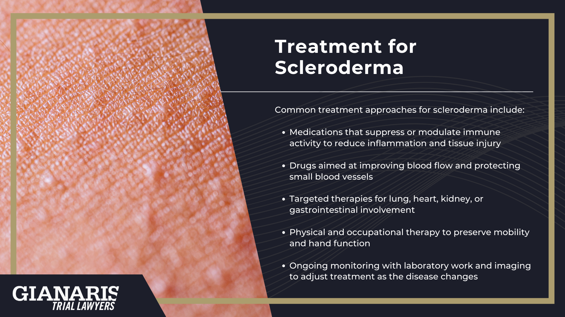 What Is Scleroderma; Scleroderma Symptoms; Treatment for Scleroderma