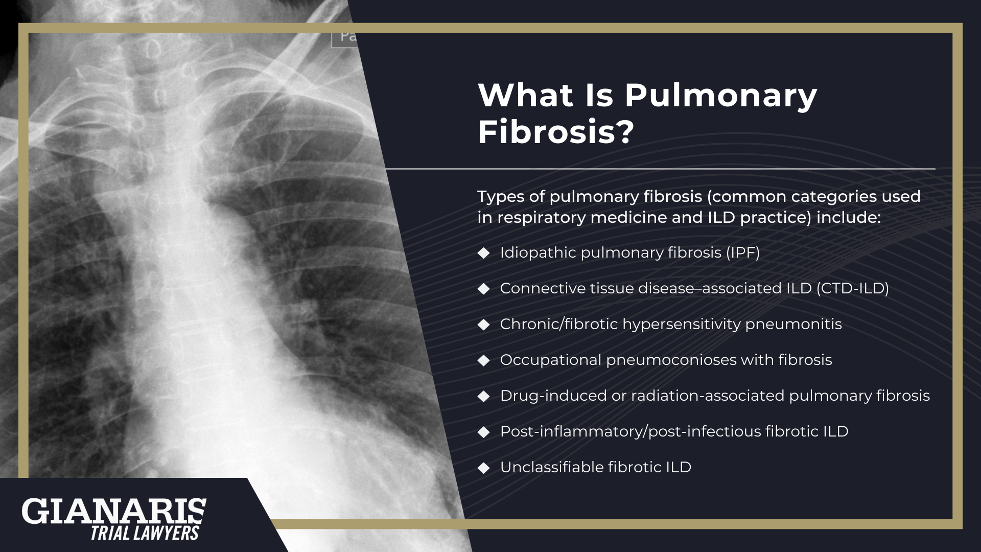 What Is Pulmonary Fibrosis