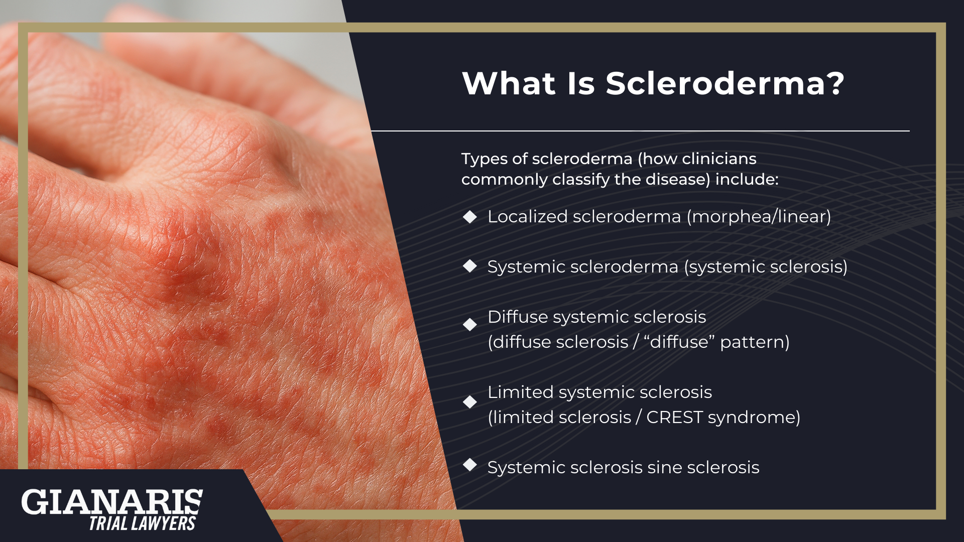 What Is Scleroderma