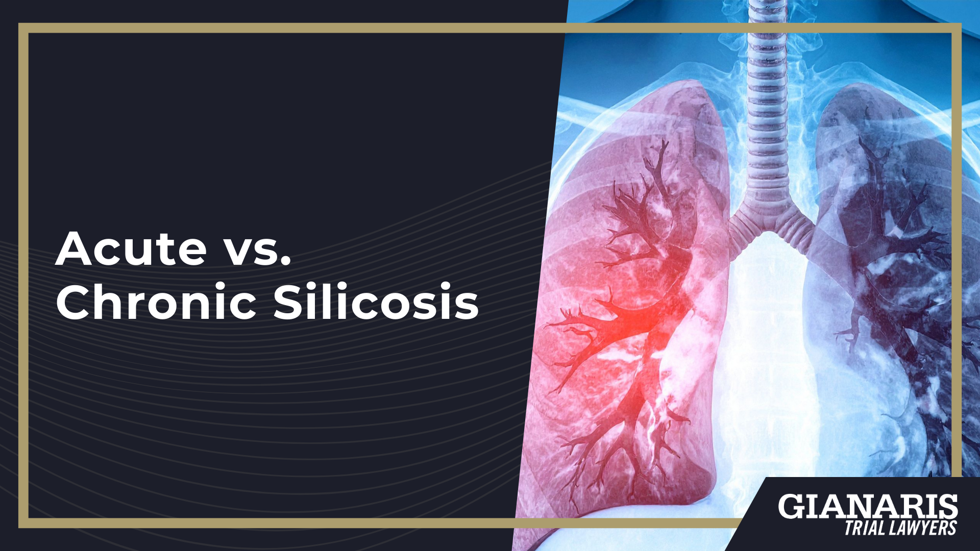 What Is Silicosis; How Crystalline Silica Dust Causes Lung Damage; Acute vs. Chronic Silicosis