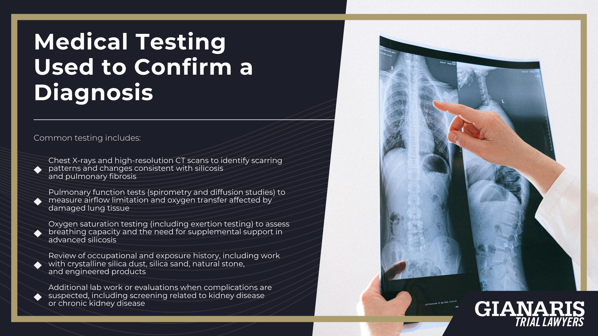 What Is Silicosis; Who Is Most at Risk for Silicosis; How Our Lawyers Can Assist; Steps to Take in a Silicosis Lawsuit; Silicosis Symptoms and Warning Signs; Medical Testing Used to Confirm a Diagnosis