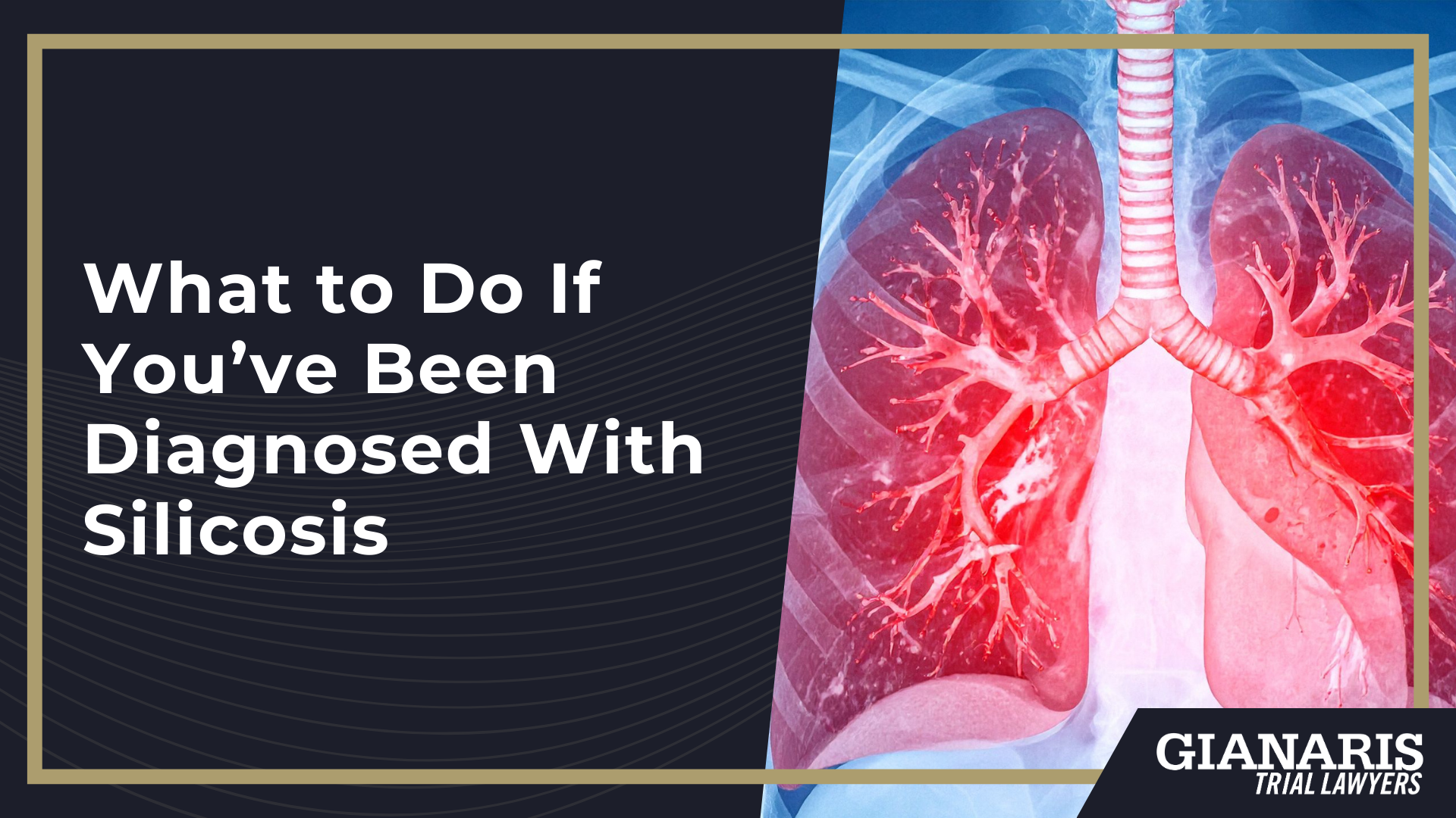 What Is Silicosis; How Crystalline Silica Dust Causes Lung Damage; Acute vs. Chronic Silicosis; What to Do If You’ve Been Diagnosed With Silicosis